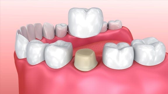 Cosmetic Dentistry